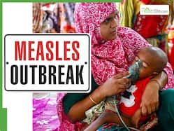 Bangladesh Measles Outbreak: 145 dead, 533 hospitalised in 24 hours - Should India be worried about cross-border transmission?