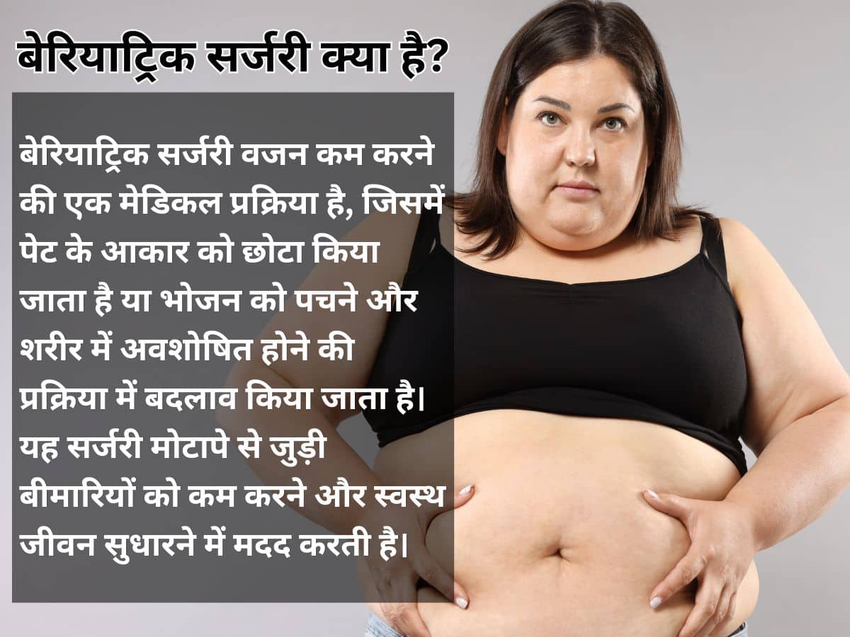 बैरियाट्रिक सर्जरी क्या है?