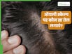 ऑयली स्कैल्प पर कौन सा तेल लगाएं?