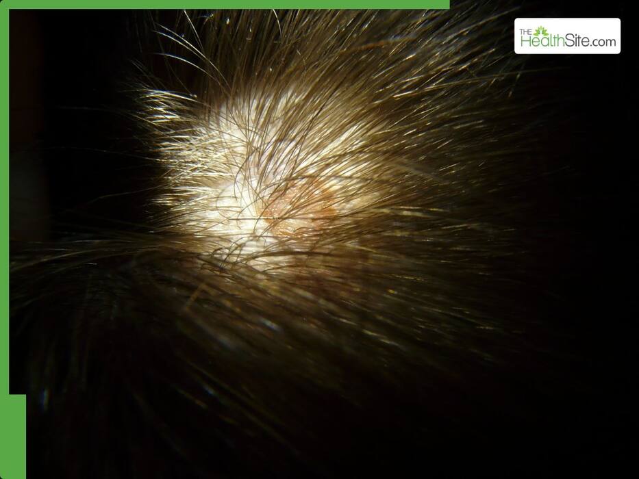 5 things that can go wrong when using castor oil on hair