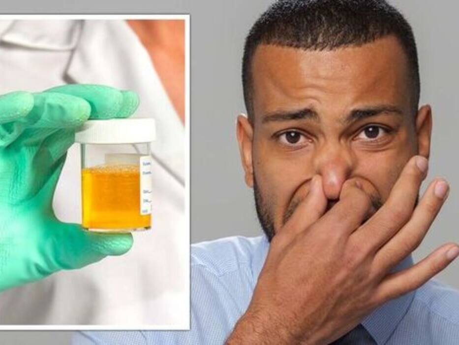 5 urine changes that could signal early kidney damage you shouldn’t ignore