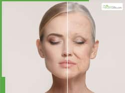 5 collagen-boosting foods you should eat instead of supplements for youthful summer skin