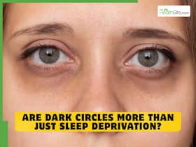 World Health Day 2026: Are dark circles more than just sleep deprivation?
