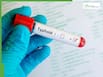 Drug-resistant typhoid in India: Why common antibiotics are failing and what you must do to stay safe