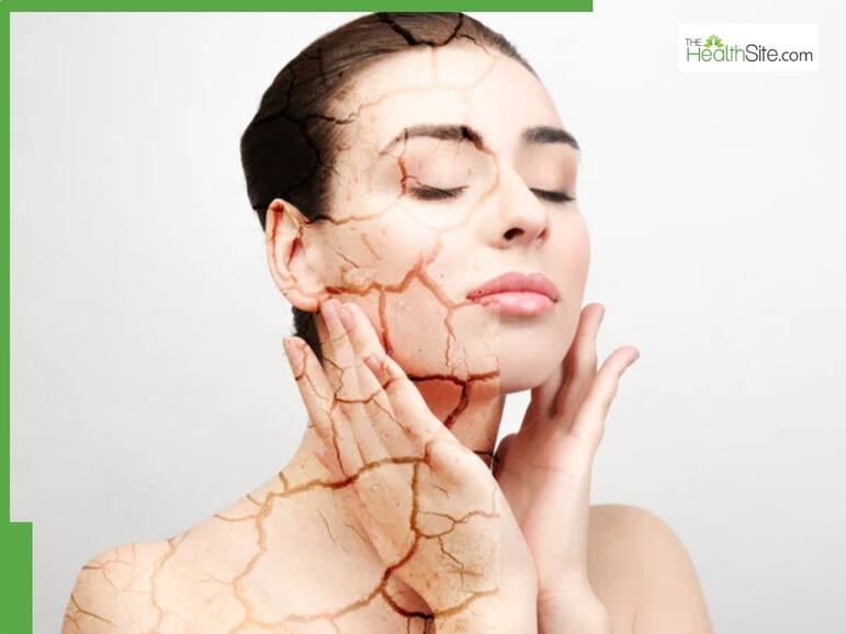 5 hidden side effects of excessive AC use that can harm your skin, breathing, and overall health