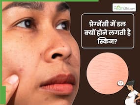 प्रेग्नेंसी में स्किन डल क्यों होती है? जानें, इसके कारण और बचाव के तरीके