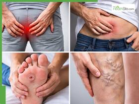 Early warning signs of piles, hernia, diabetic foot and varicose veins you should never ignore