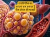 फैट सेल्स की गड़बड़ी बढ़ा सकता है डायबिटीज होने का खतरा, नई रिसर्च में बताया इसका कारण