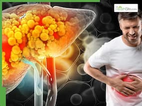 Fatty Liver: Doctor explains how excess energy, fructose, and insulin resistance damage your liver