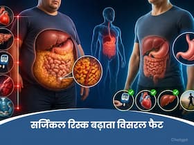 सर्जिकल रिस्क बढ़ा सकता है विसरल फैट, जानें कैसे बैरिएट्रिक सर्जरी खतरे को करती है कम सर्जिकल रिस्क बढ़ा सकता है विसरल फैट, जानें कैसे बैरिएट्रिक सर्जरी खतरे को करती है कम