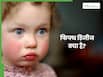 बच्चों के गाल पर दिख रहे हैं थप्पड़ जैसे निशान? Fifth disease के हो सकते हैं लक्षण