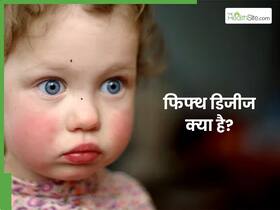 बच्चों के गाल पर दिख रहे हैं थप्पड़ जैसे निशान? Fifth disease के हो सकते हैं लक्षण