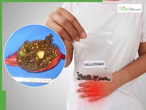 Gallstones symptoms: From dark urine colour to recurrent UTIs - What happens when the gallbladder is not functioning? Gallstones symptoms: From dark urine colour to recurrent UTIs - What happens when the gallbladder is not functioning?