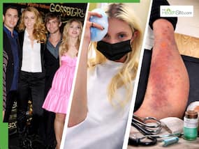 Taylor Momsen hospitalized after venomous bite: Expert warns of dangers