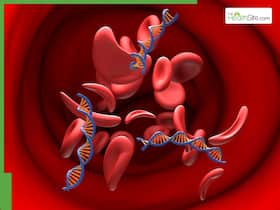 Haemophilia A vs B: Which is more severe? Here’s what sets them apart