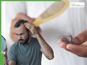 Could baldness become rare by 2050? Expert explains the science behind hair loss Could baldness become rare by 2050? Expert explains the science behind hair loss