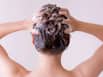 5 easy DIY scalp exfoliation remedies for healthy, dandruff-free hair at home