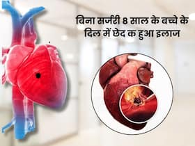 8 साल के बच्चे के दिल में हुआ छेद, बिना ओपन-हार्ट सर्जरी डॉक्टरों ने बचाई जान