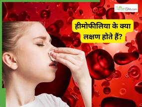 World Hemophilia Day: एक्सपर्ट से जानें हीमोफीलिया के शुरुआती लक्षण क्या हैं? और इन्हें इग्नोर क्यों नहीं करना चाहिए?