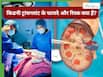 ​किडनी ट्रांसप्लांट से पहले मरीज को जरूर पूछने चाहिए डॉक्टर से ये 10+ सवाल
