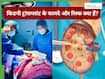 ​किडनी ट्रांसप्लांट से पहले मरीज को जरूर पूछने चाहिए डॉक्टर से ये 10+ सवाल