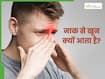इन 5 कारणों कारणों से नाक से आने लगता है ब्लड, डॉक्टर से जानें बचाव के उपाय