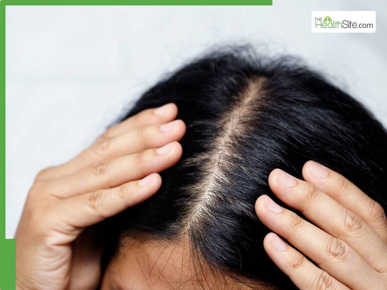 5 South Indian hair oil recipes for faster hair growth
