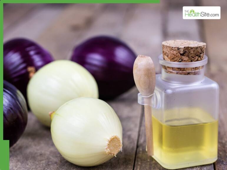 5 Best natural oils to mix with almond oil for faster hair growth on oily scalp