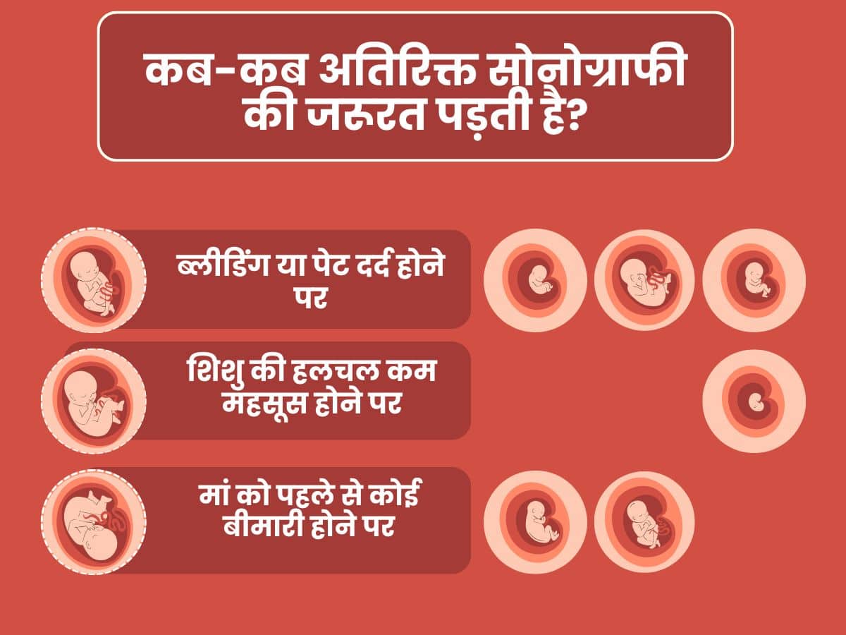 कब-कब अतिरिक्त सोनोग्राफी की जरूरत पड़ती है?