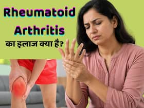 क्या रूमेटाइड अर्थराइटिस लाइलाज है? जानें कैसे किया जाता है इस बीमारी के मरीजों का उपचार