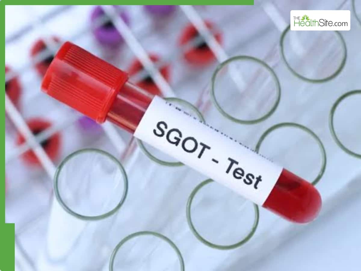 SGOT Test Explained: Normal range, causes of high levels, s…