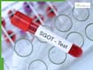 SGOT Test Explained: Normal range, causes of high levels, symptoms and how to lower liver enzymes naturally