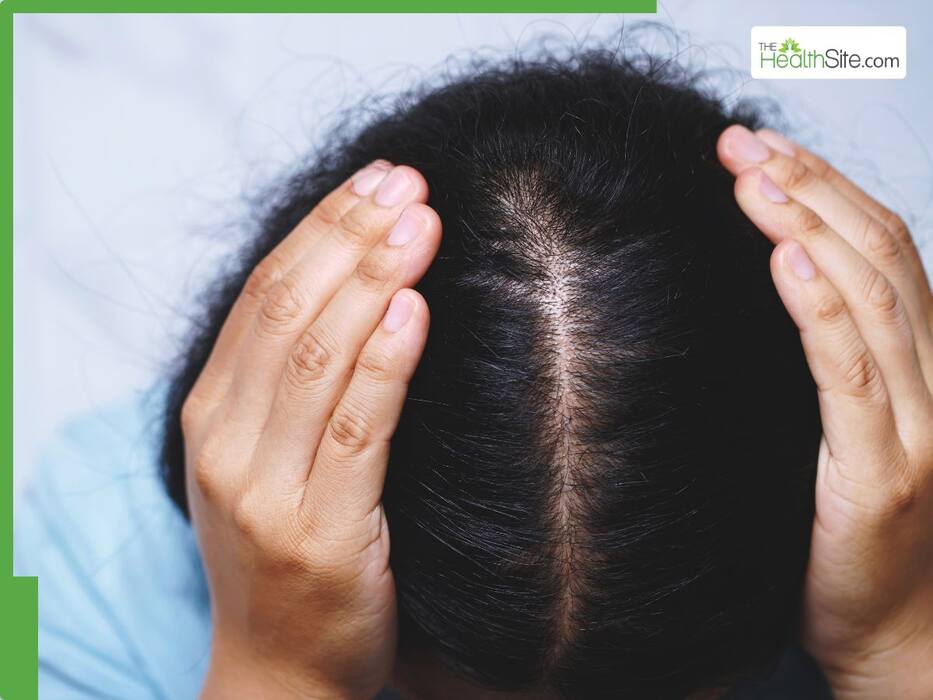 5 things that can go wrong when using castor oil on hair