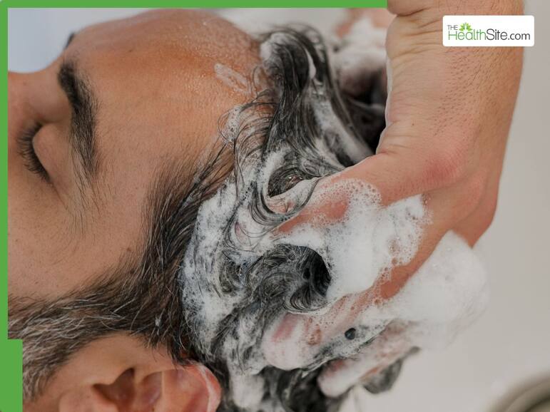 5 easy hair washing tips to control oily scalp in summer humidity
