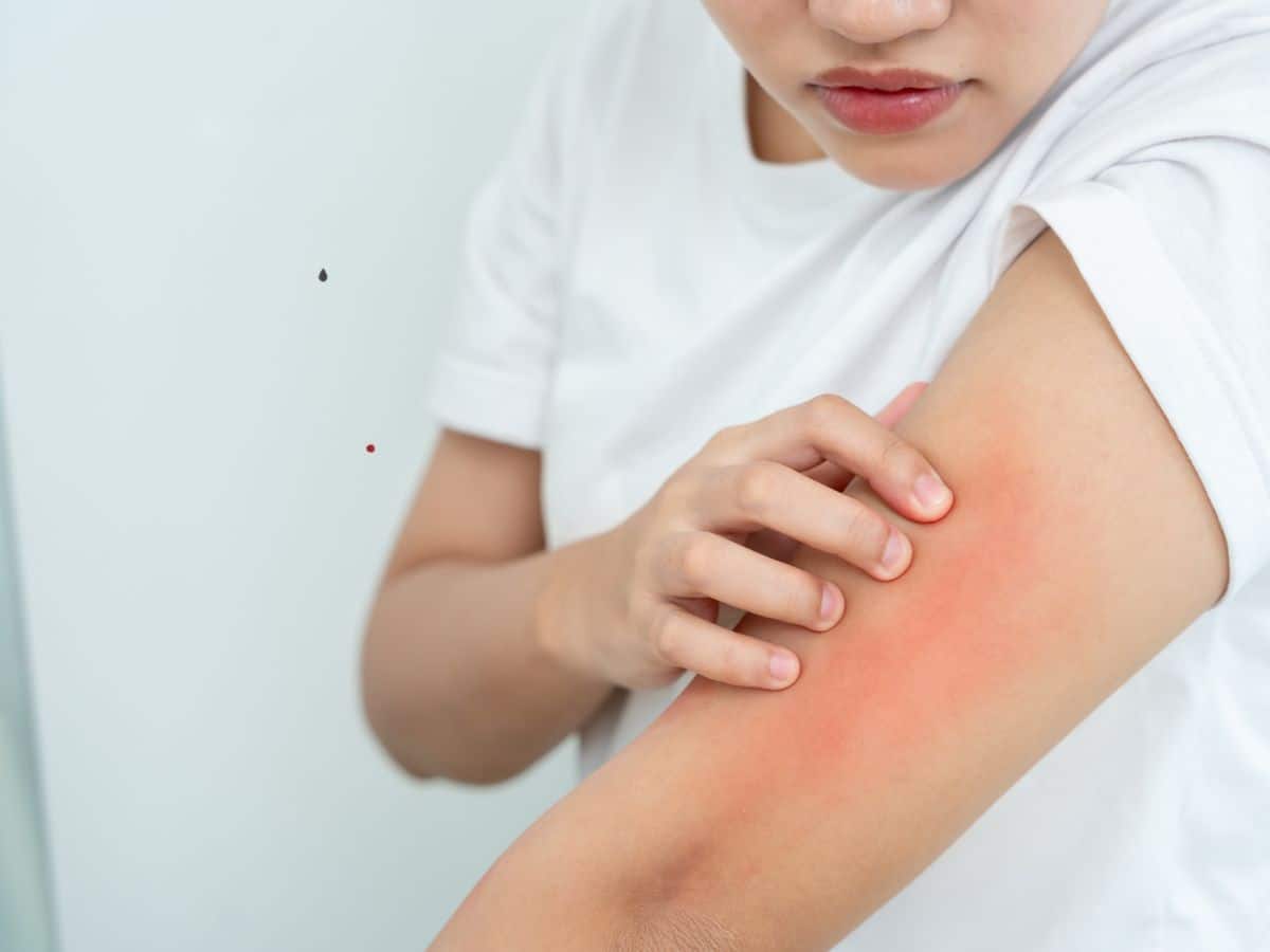 Skin rash Causes