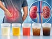 5 urine changes that could signal early kidney damage you shouldn   t ignore