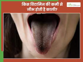 किस विटामिन की कमी से जीभ काली हो जाती है?