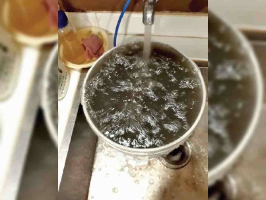 इन 5 कारणों से पेट में हो सकता है इन्फेक्शन, संकेत दिखने पर कराएं जांच