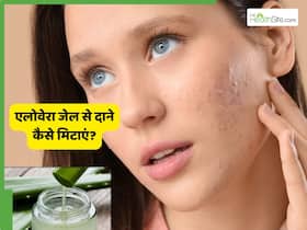 क्या एलोवेरा जेल चेहरे के छोटे-छोटे दाने मिटा सकता है? 