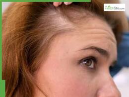 5 best oils to grow new hair on bald patches in women