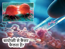 क्या सच में बायोप्सी कराने से कैंसर के पूरे शरीर में फैलने का खतरा बढ़ जाता है? Oncologist से जानें सच