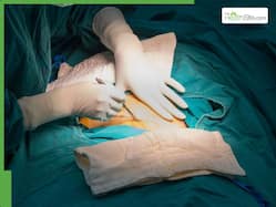 Rising c-section rates worldwide: Hidden risks, causes and why awareness around normal delivery is crucial