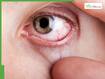 Diabetic eye disease: Silent threat causing preventable blindness, early signs, risks and how to protect your vision