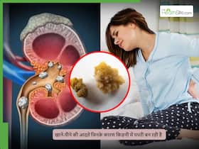 खानपान में की जाने वाली वे कौन सी गलतियां हैं, जिनके कारण किडनी स्टोन होने का खतरा बढ़ता है?