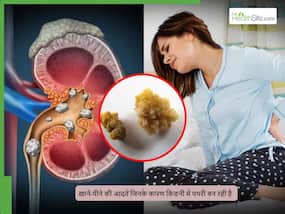 खानपान में की जाने वाली वे कौन सी गलतियां हैं, जिनके कारण किडनी स्टोन होने का खतरा बढ़ता है?