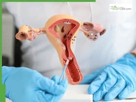 Hormonal imbalance or a warning sign? Doctor explains why irregular periods and postmenopausal bleeding could indicate endometrial cancer