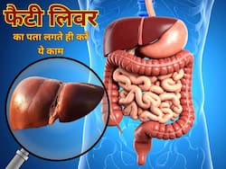 फैटी लिवर की पहली स्टेज में कौन से लक्षण दिखते हैं? डॉक्टर ने बताया रिपोर्ट पॉजिटिव आने पर कैसे रखें अपना ध्यान