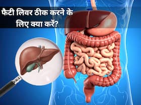 क्या फैटी लिवर सिर्फ बाहर का खाना बंद करने से ही सही होता है? डॉक्टर ने बताया कैसे ठीक होगी समस्या क्या फैटी लिवर सिर्फ बाहर का खाना बंद करने से ही सही होता है? डॉक्टर ने बताया कैसे ठीक होगी समस्या