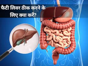 क्या फैटी लिवर सिर्फ बाहर का खाना बंद करने से ही सही होता है? डॉक्टर ने बताया कैसे ठीक होगी समस्या