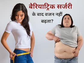 बेरियाट्रिक सर्जरी क्या है? वेट लॉस करने की बजाय लोग इसे क्यों चुन रहे हैं?